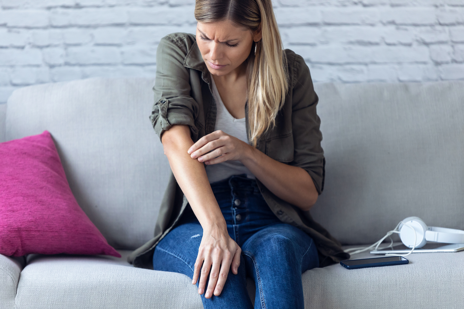 eczema